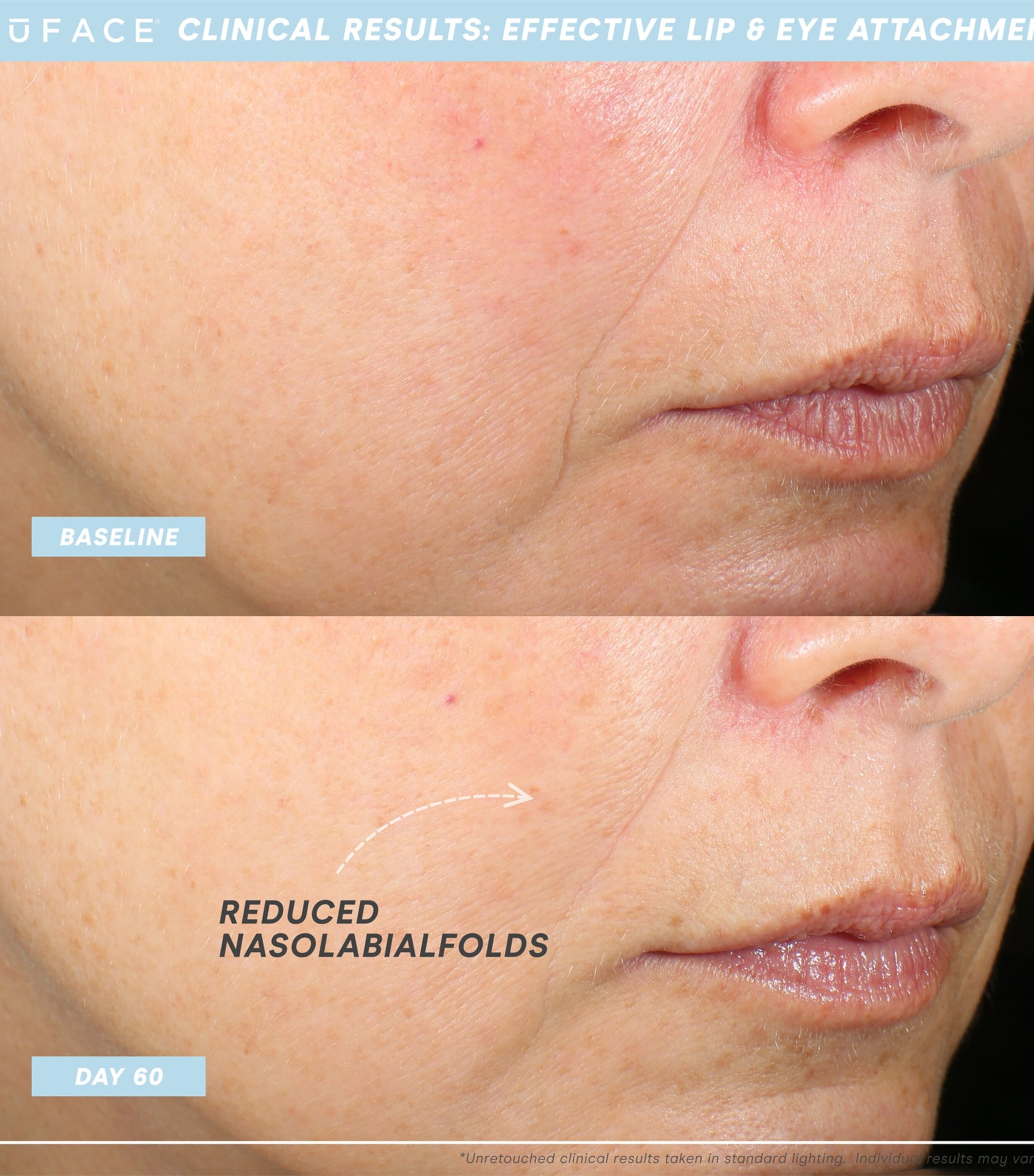 Trinity+ Eye and Lip Set