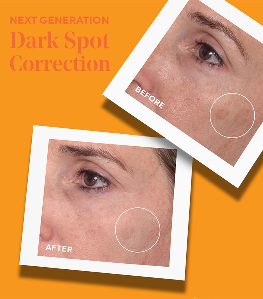 Rapid Dark Spot Correcting Serum (30ml)