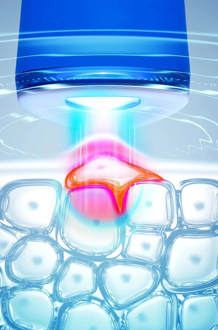 FOREO ESPADA 2 Cobalt Blue Mavi LED Işıklı Akne Tedavi Cihazı