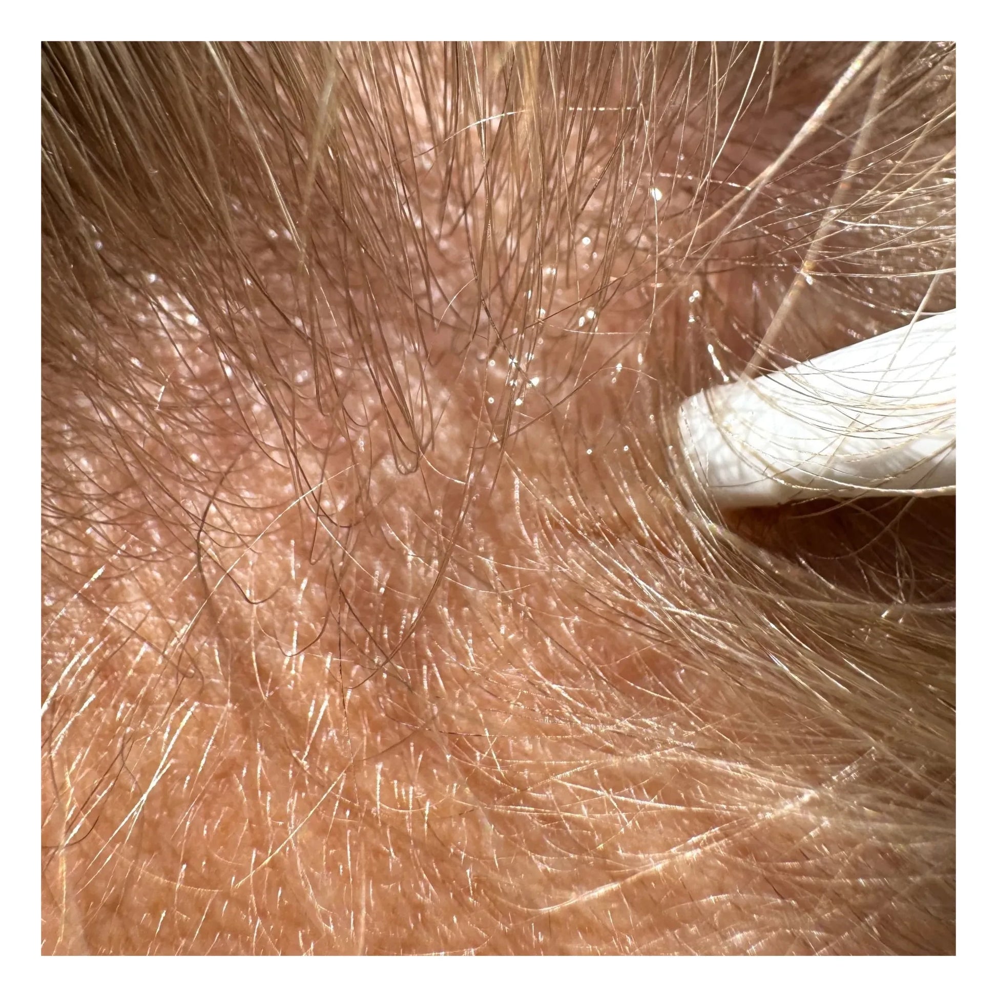 SoKind - Hair Serum - Pure Growth - 100 ml