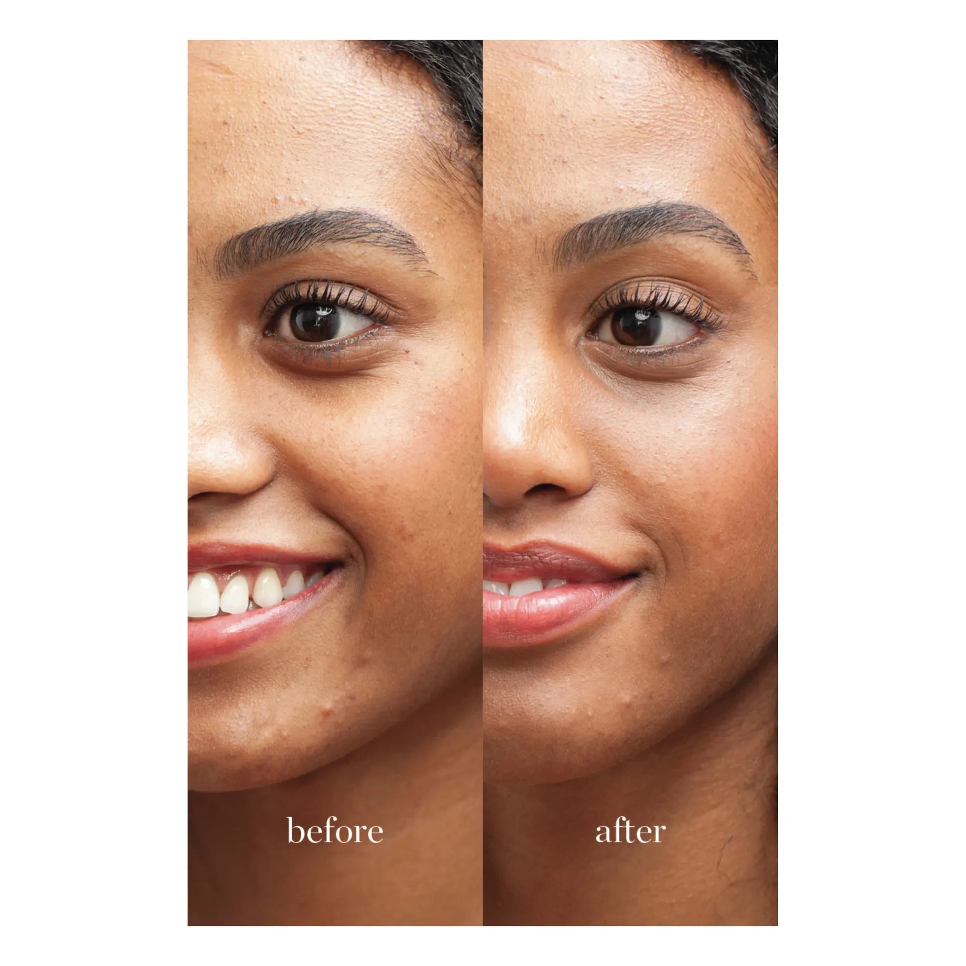 Ere Perez - Lychee Concealer - 10ml | Seis