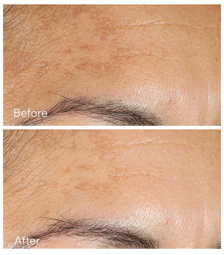 Vita C Glycolic Serum (30ml)