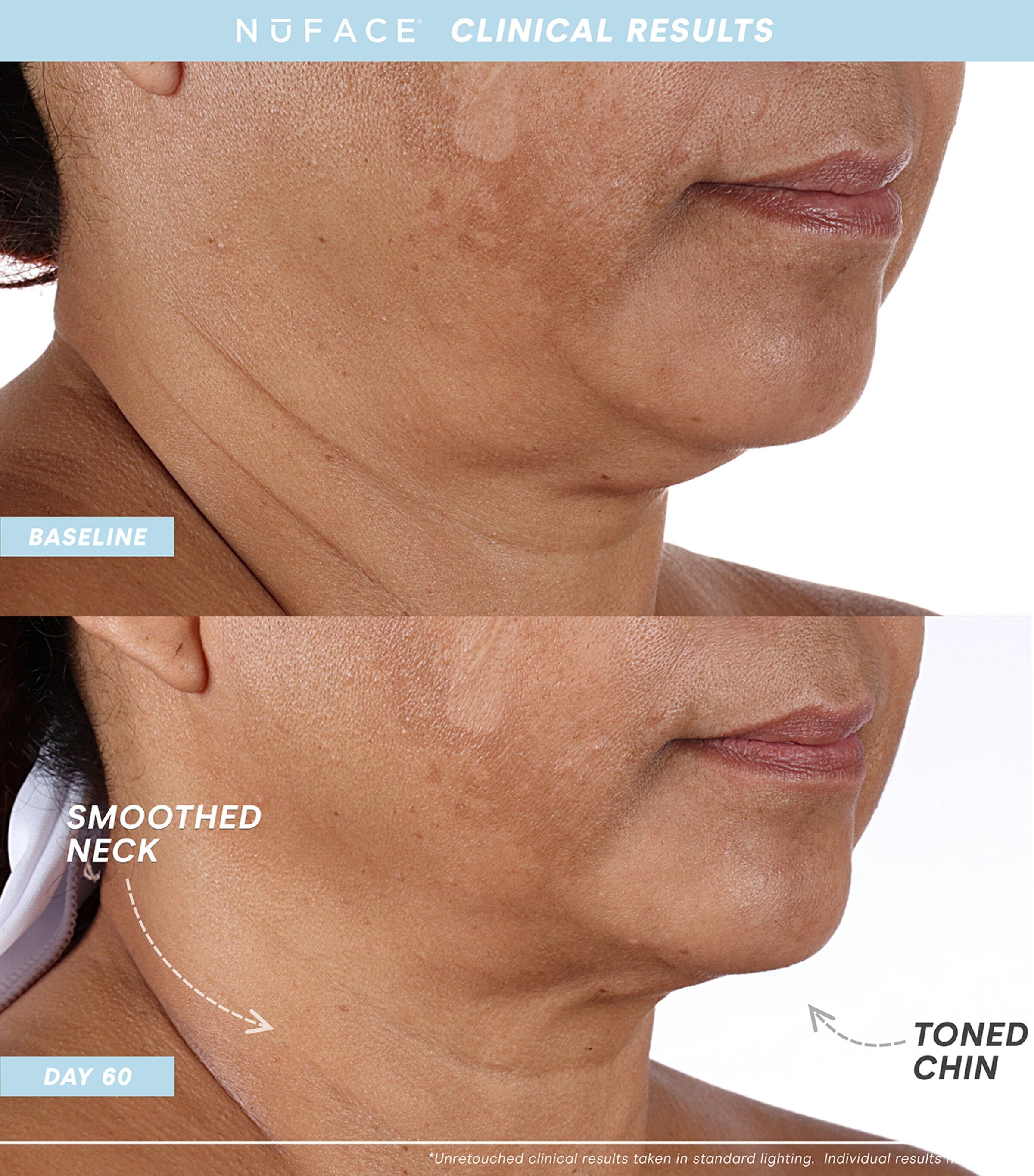 Trinity+ Eye and Lip Set