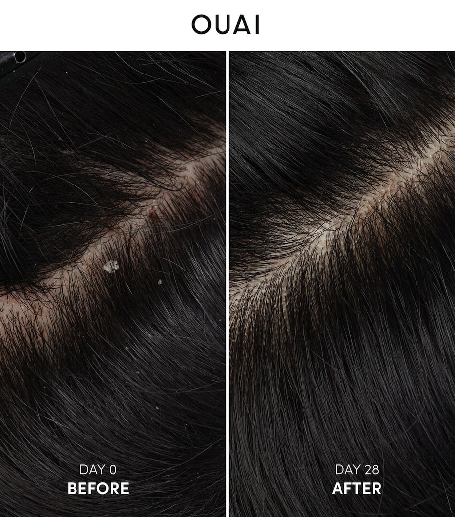 Anti-Dandruff Shampoo (300ml)