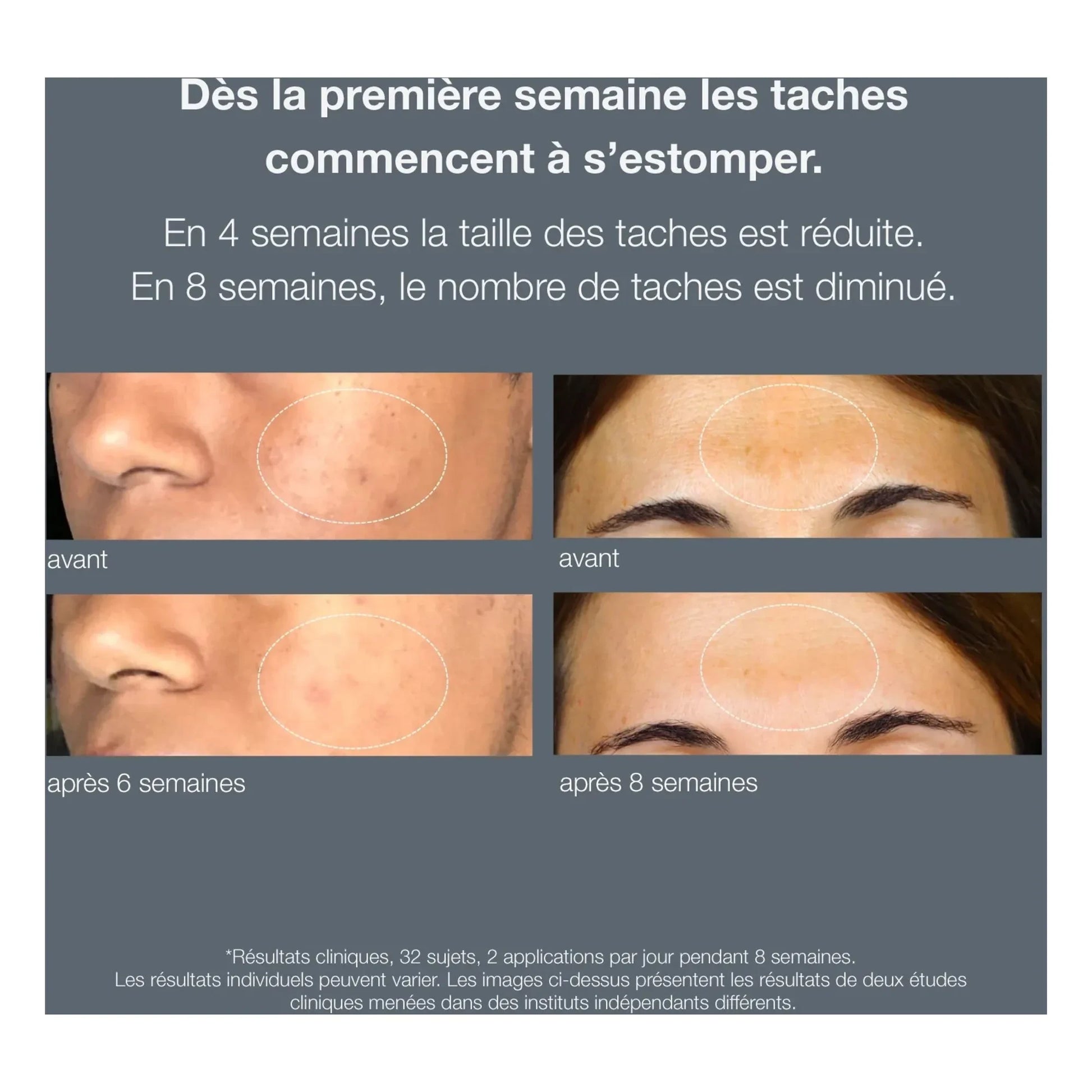 Dermalogica - Serum powerbright anti-tache - 30ml