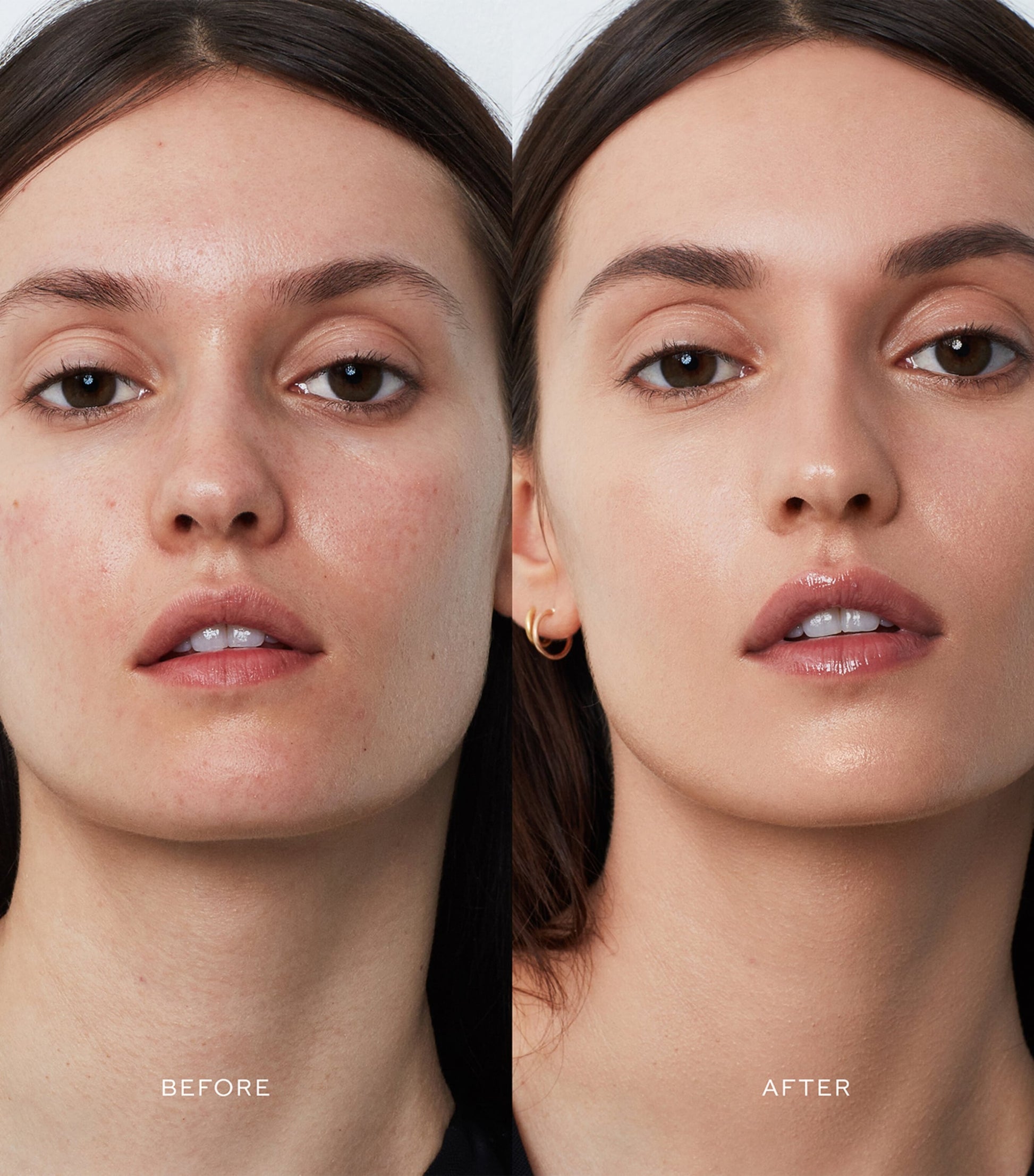 Vital Skincare Complexion Drops