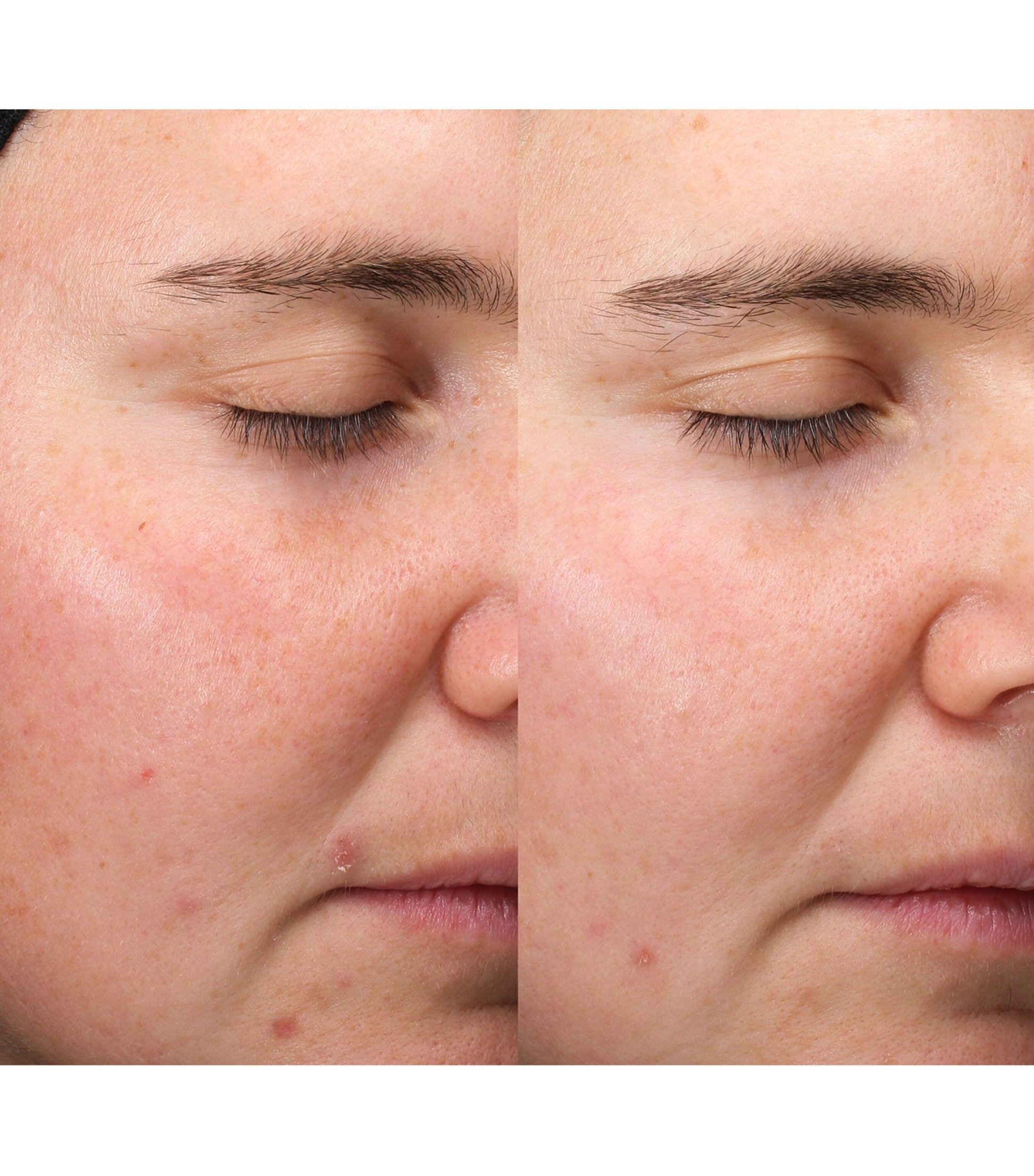 Exosome Hydro-Glow Complex Serum (30ml)