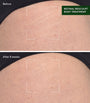 Retinal ReSculpt Body Treatment (148ml)