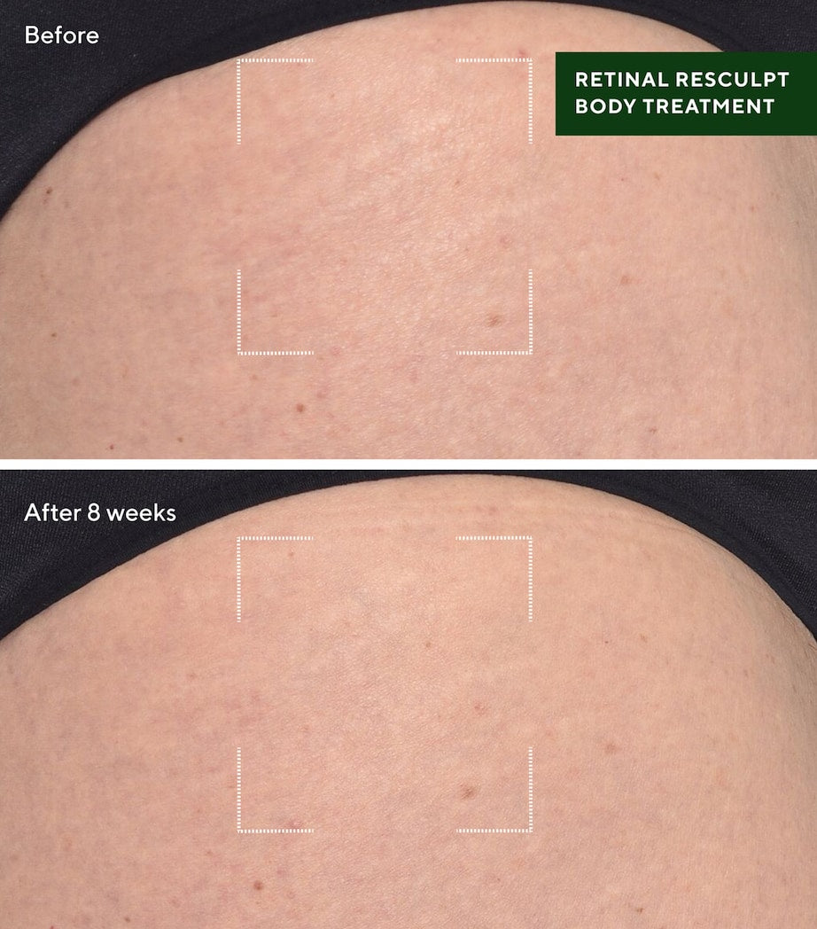 Retinal ReSculpt Body Treatment (148ml)