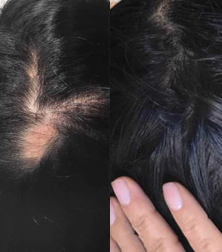 Advanced Formula (30 Capsules)