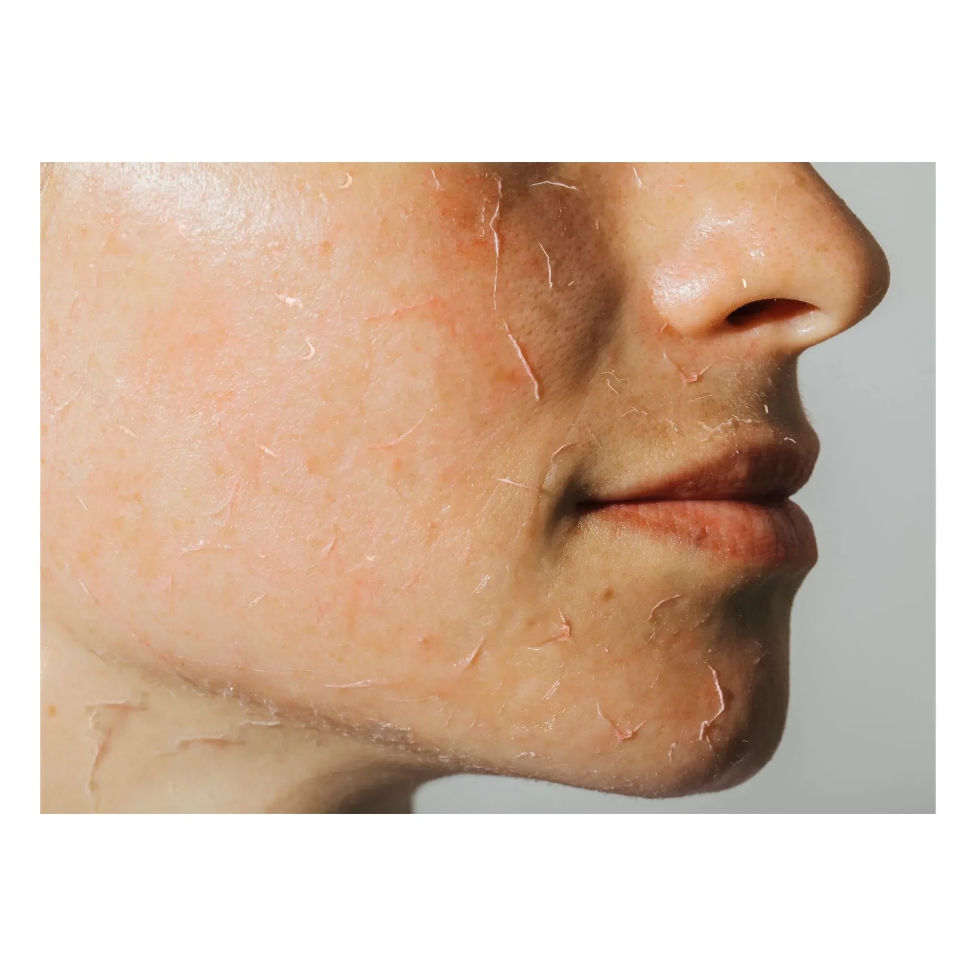 Odacité - Bioactive Rose Gommage