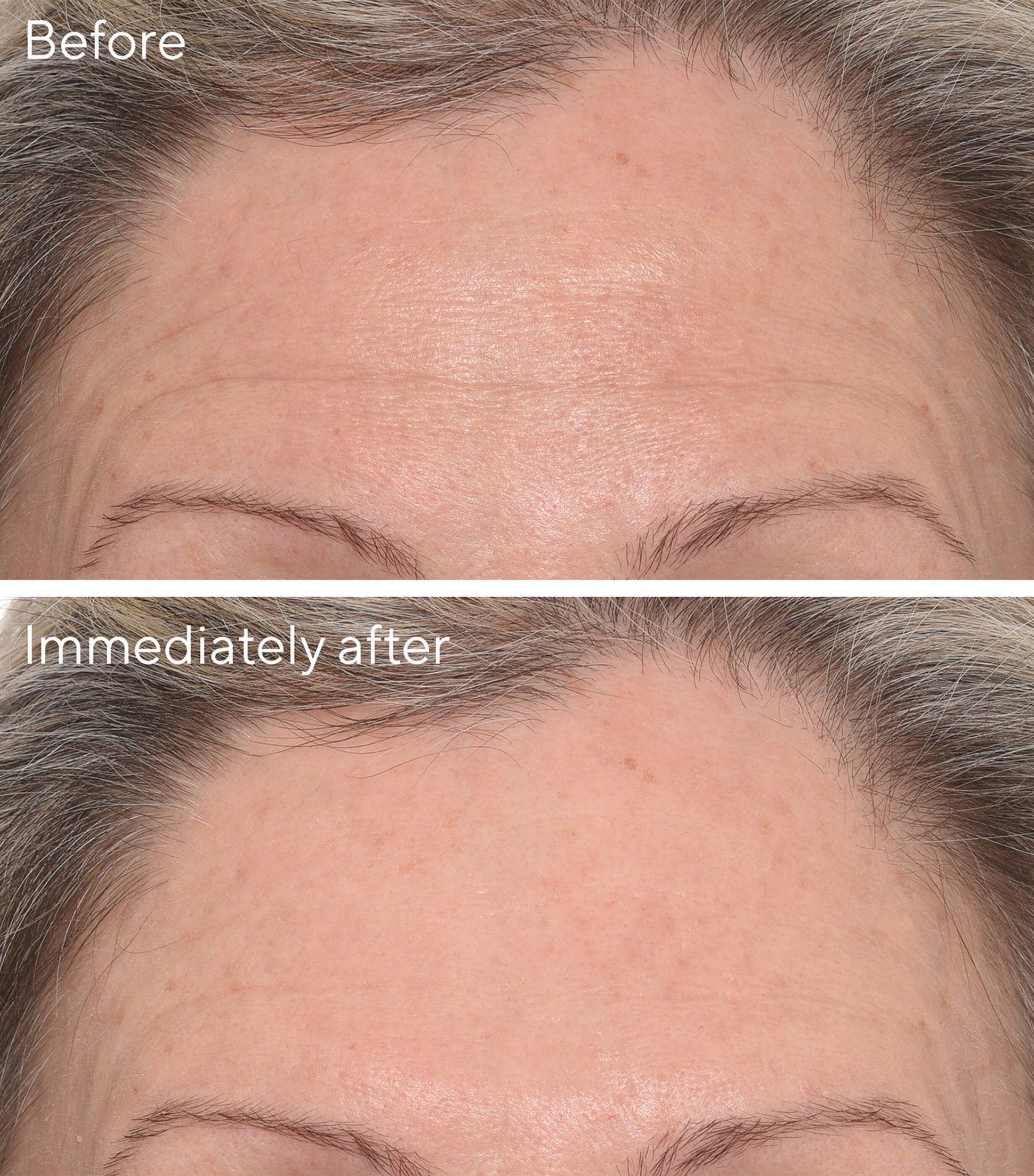 Murad Targeted Wrinkle Corrector (15ml)