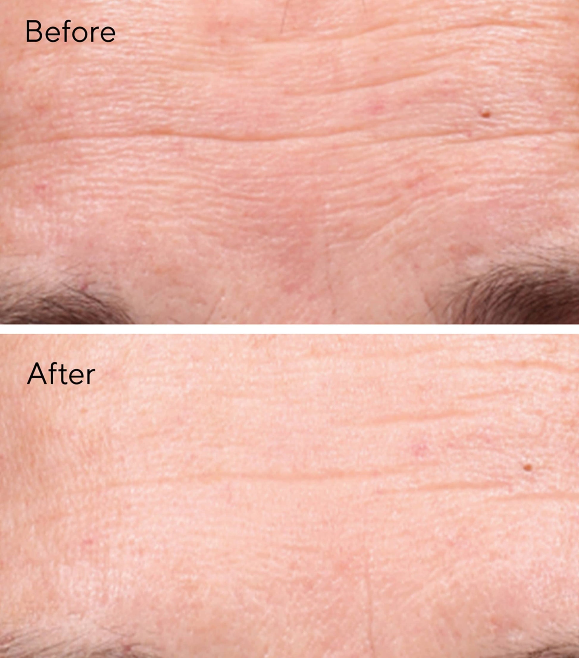 Retinol Youth Renewal Serum (30ml)