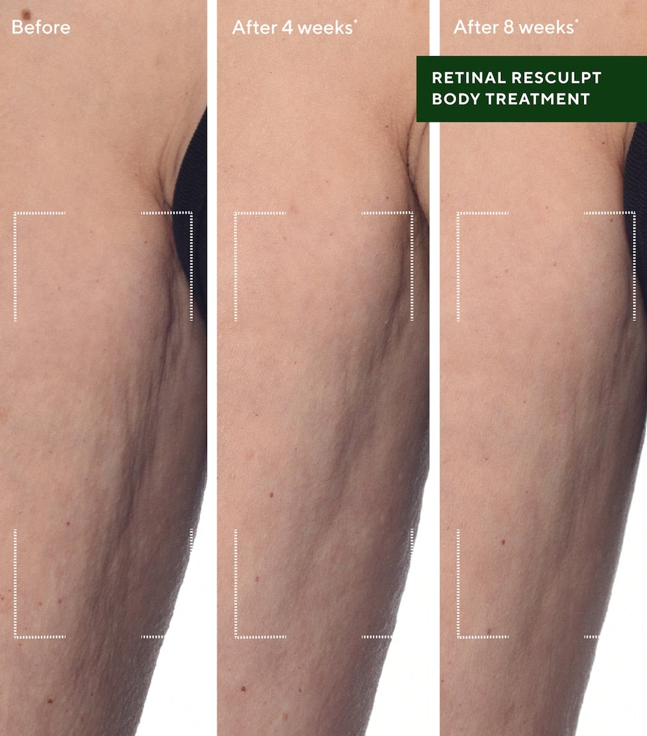 Retinal ReSculpt Body Treatment (148ml)