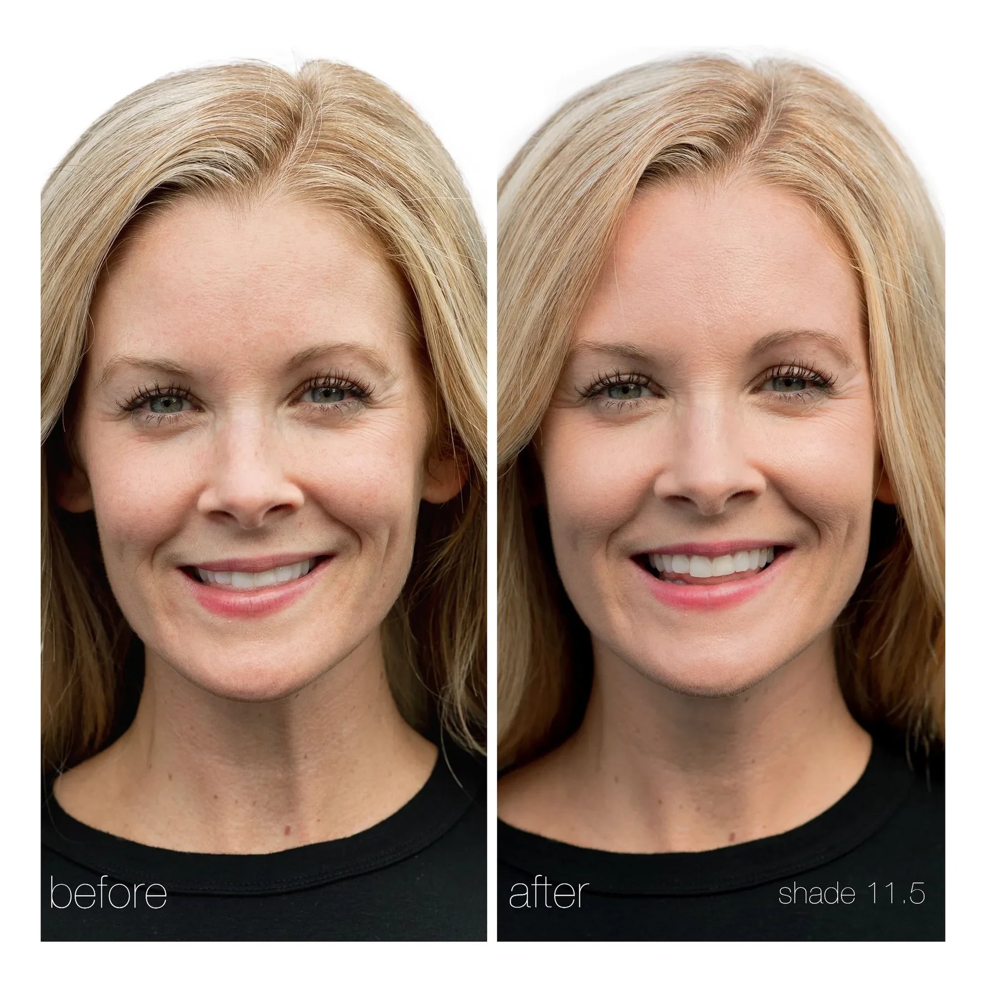 RMS Beauty - UnCoverup Concealer - 5.67g | 11,5